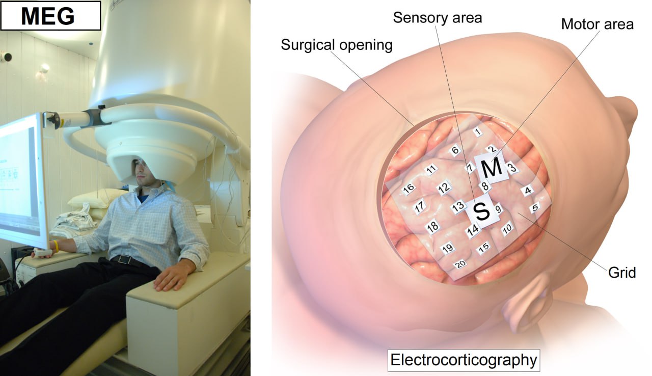 Способы измерять активность мозга: МЭГ, ЭКоГ и как выглядят разные модальности для ИИ